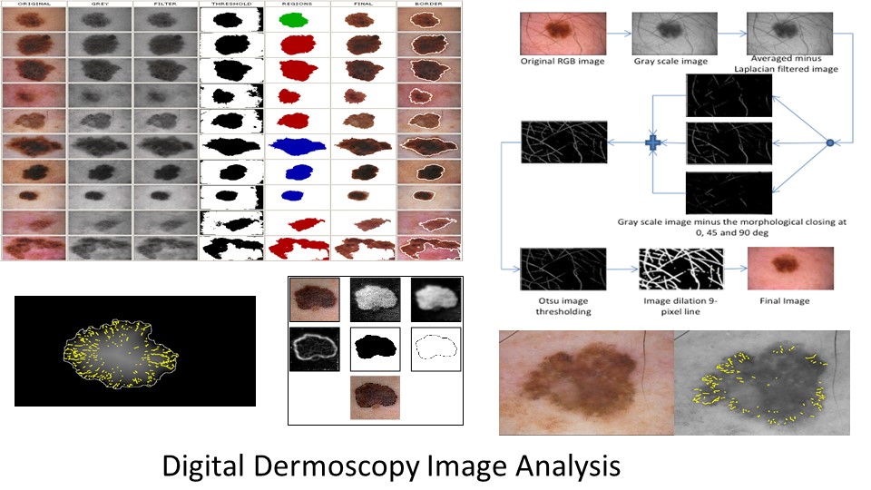 Digital Dermoscopy Image Analysis