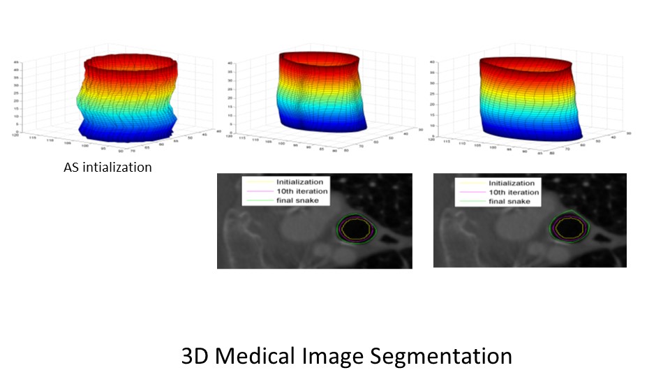 3D Medical Image Segmentation